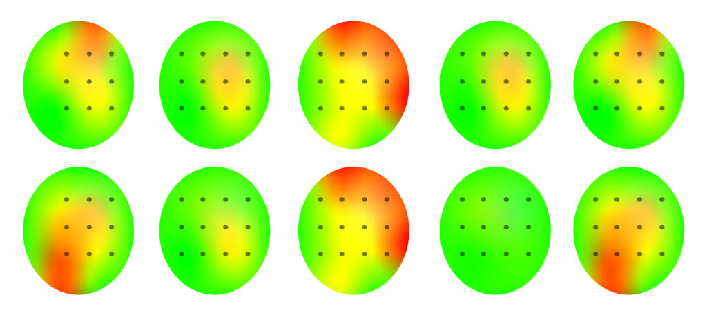 A series of 10 circles representing a top-down view of qEEG brain scans. These are sample, demonstration images only.