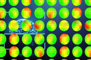 qEEG scan results showing top-down colored green, yellow, and red gradients on a blue background.